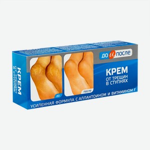 Крем для ног от трещин в ступнях  До и после , 50 мл